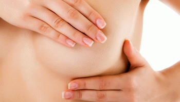 Mastectomía y reconstrucción mamaria